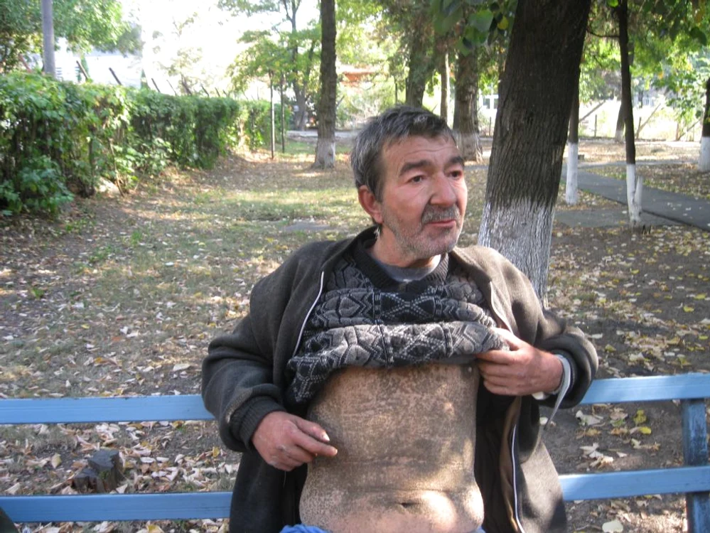 Daniel Simion Suciu are o boală rară