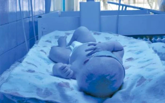 Lumina polarizată albastră tratează icterul bebeluşilor