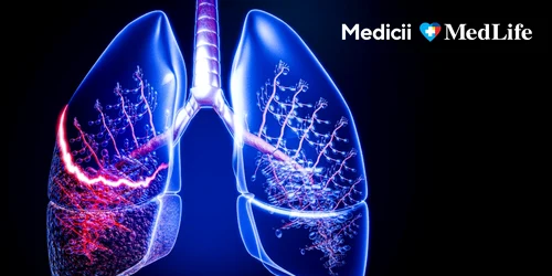 Dr Andrei Dobrea, MedLife jpeg