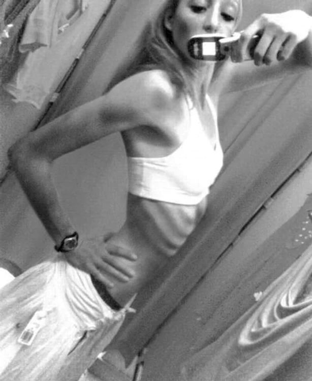 Anorexicele sunt sexy?
