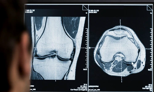 back view doctor looking ct scans computer jpg