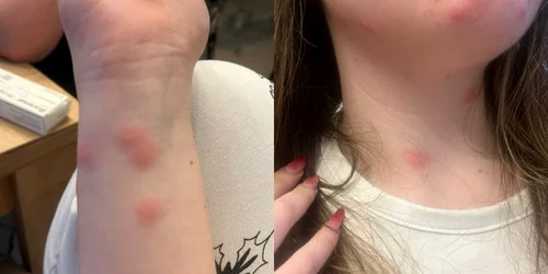 muscaturi plosnite tren cfr foto europa fm jpg