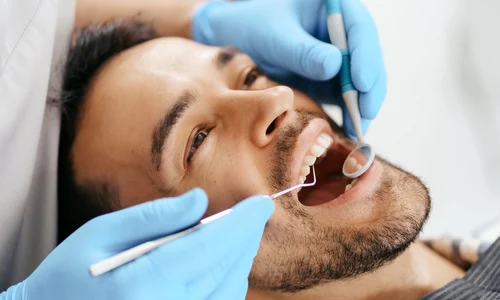 5 beneficii ale microscopului de calitate pentru medicul dentist jpg