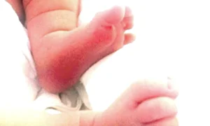 Giulia a postat pe  Facebook o poză cu  picioarele bebeluşului jpeg
