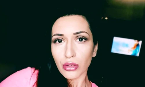 Andra și a injectat acid hialuronic în buze jpeg