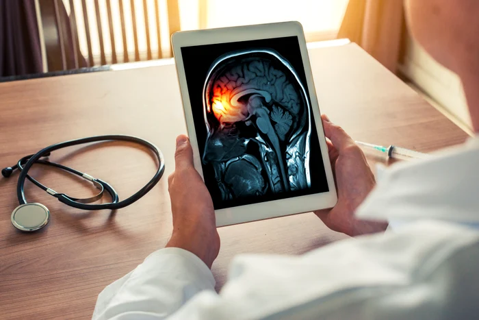 Care sunt simptomele meningitei / Foto: Shutterstock