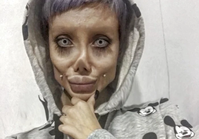 Sahar Tabat s-a desfigurat în încercarea de a semăna cu idolul său, Angelina Jolie