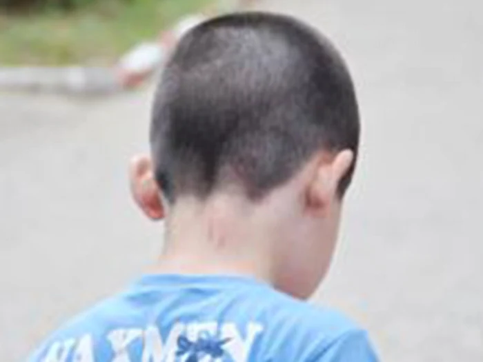 Copilul bătut nu poate vorbi FOTO arhiva Adevărul