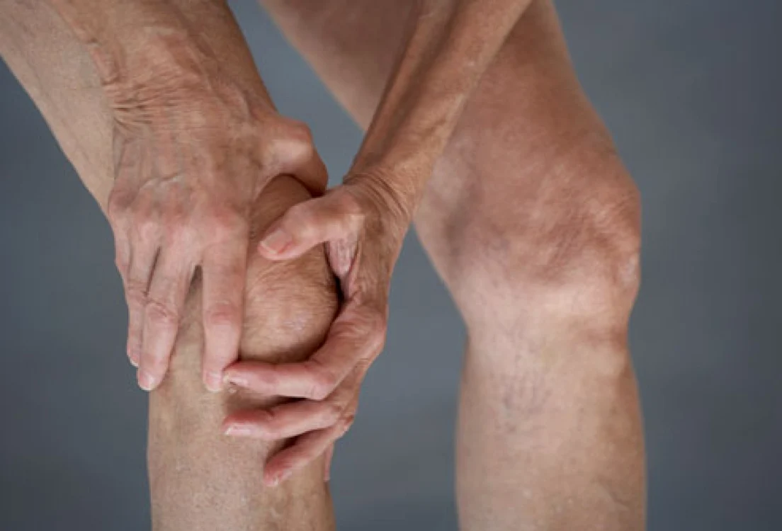 Articulaţiile sunt părţi fragile, iar odată ce cartilajele se erodează se refac cu dificultate FOTO webmd.com