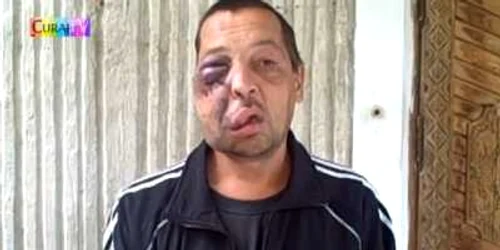 Bărbatul susține că a fost bătut de polițiști