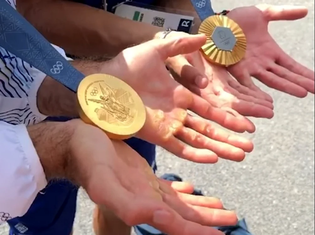 Așa arată palmele celor doi campioni olimpici. Foto Facebook 