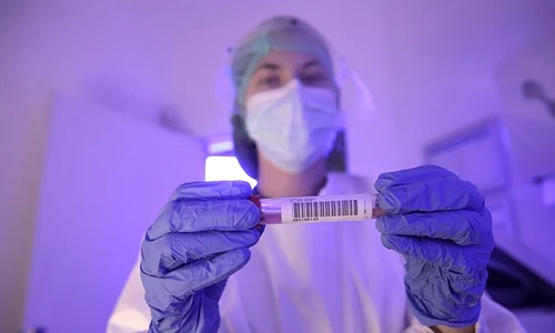 1 testare covid 19 sanador jpg jpeg