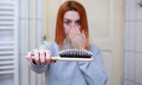 hair loss 4818761 960 720 jpg