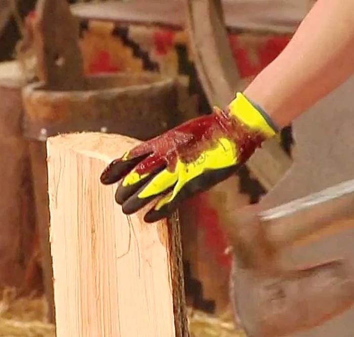 Prin bucata de mănuşă sfâşiată, sângele a ţâşnit-şiroaie