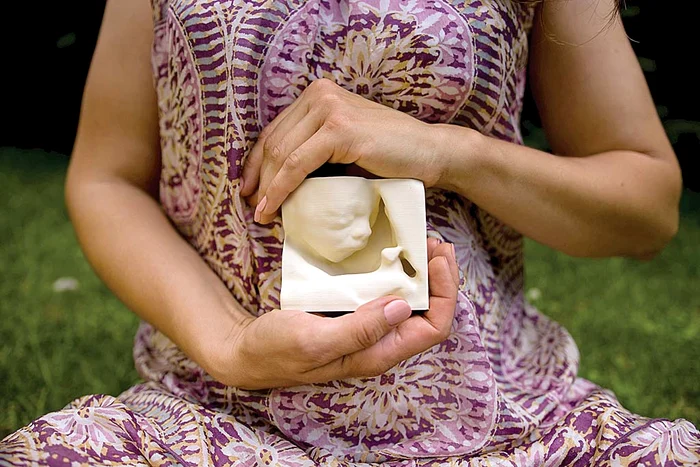 Cu această ecografie, inclusiv nevăzătoarele “îşi văd” copiii din burtică