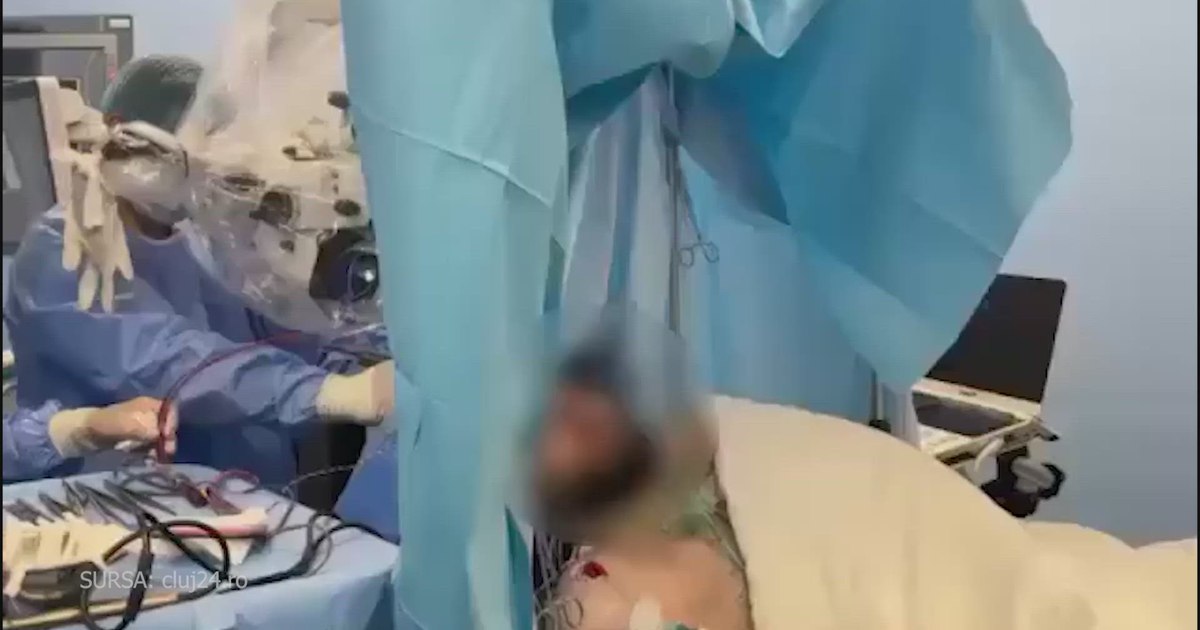 Un bariton de la Filarmonica din Cluj cântă în timpul unei operații pe creier.
