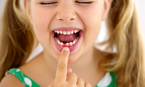 1 dinti de lapte jpg jpeg