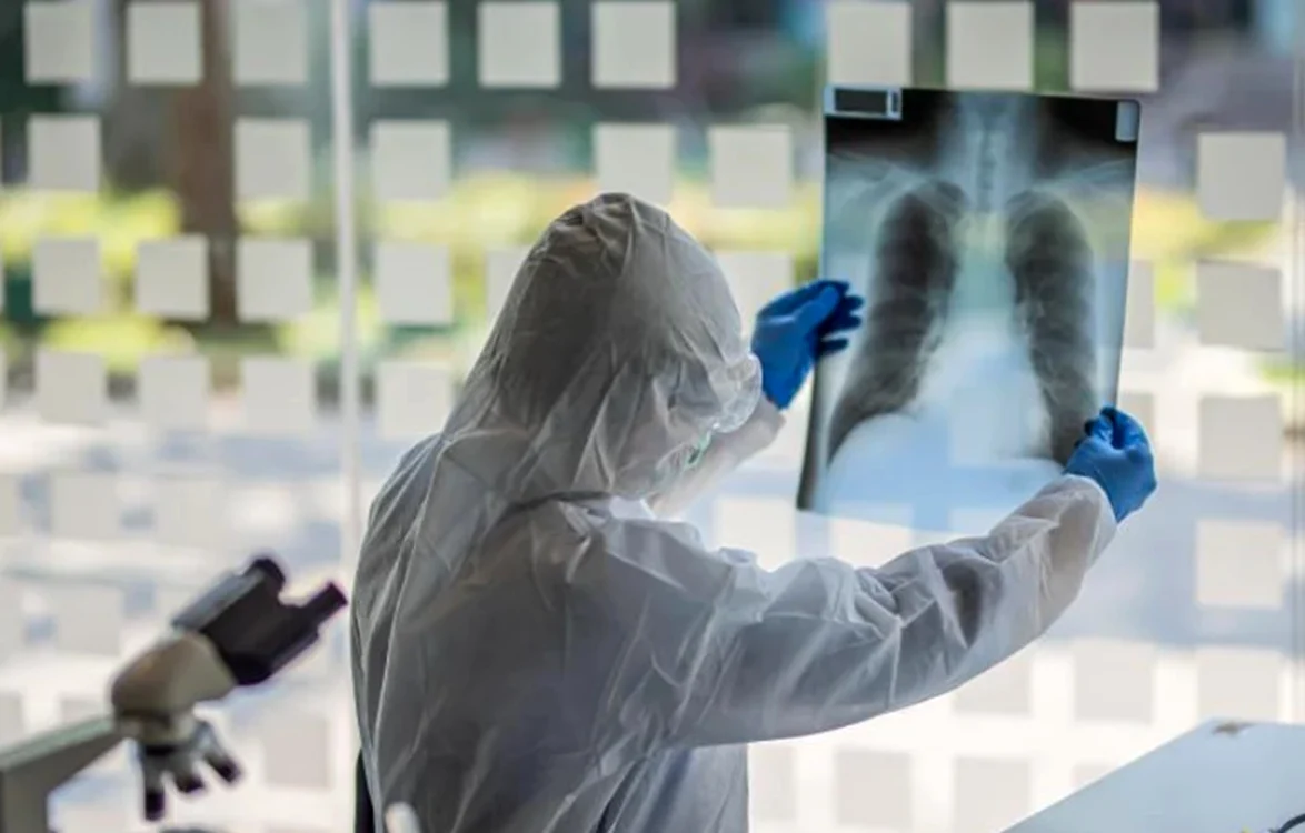 Un medic analizează o radiografie la plămâni