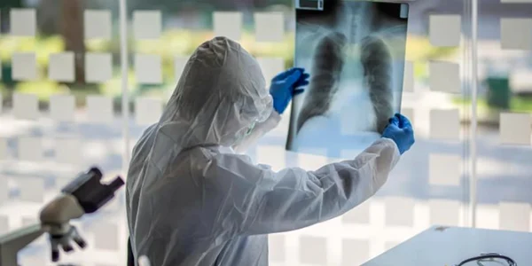 medic radiografie plamani jpg