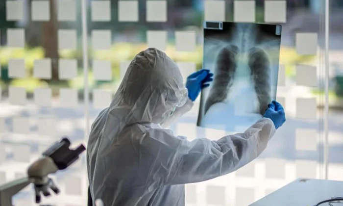 medic radiografie plamani jpg
