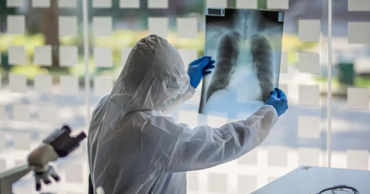 Nodulul pulmonar: ce este, ce simptome provoacă și când devine îngrijorător. Ce se știe despre problema de sănătate a Papei Leon