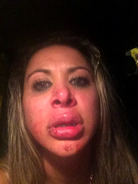 Modelul a pierdut mai multe contracte din cauza chipului ei desfigurat