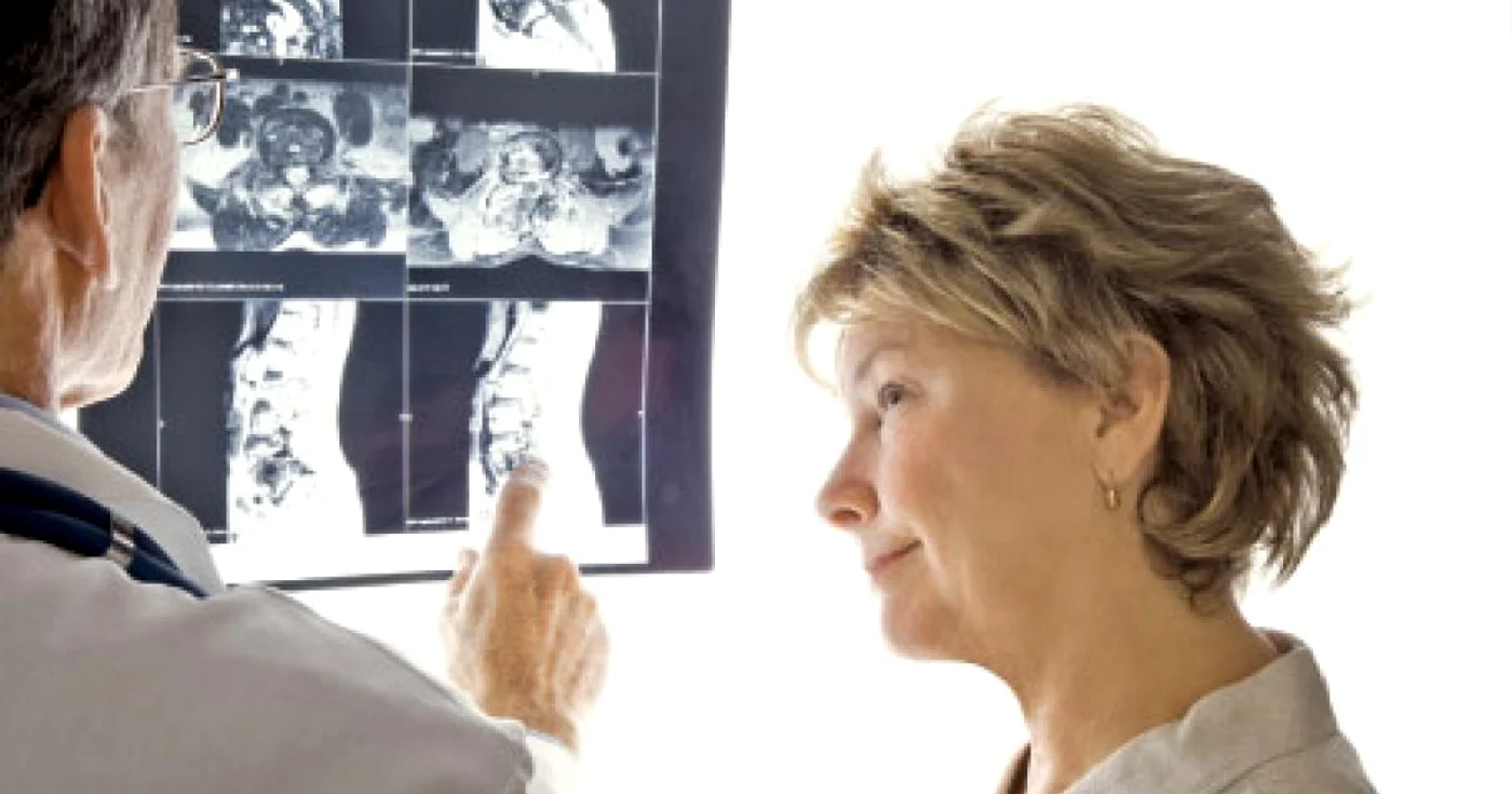 Cu cât vârsta de instalare a menopauzei este mai mică, cu atât creşte riscul  de fracturi  