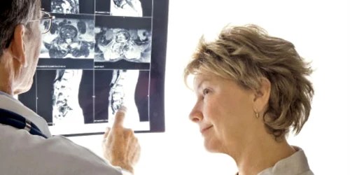 Cu cât vârsta de instalare a menopauzei este mai mică, cu atât creşte riscul  de fracturi  