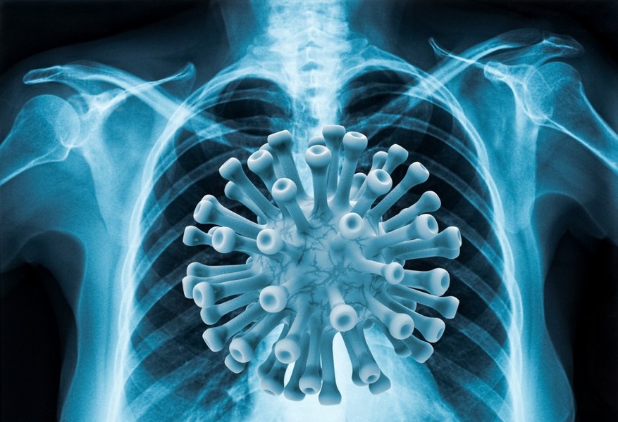 Cercetătorii chinezi au creat o tulpină mutantă de coronavirus care atacă creierul. „Această nebunie trebuie oprită”, avertizează oamenii de știință occidentali