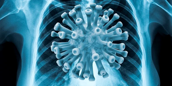 Plămâni infecţie COVID-19 FOTO SHUTTERSTOCK