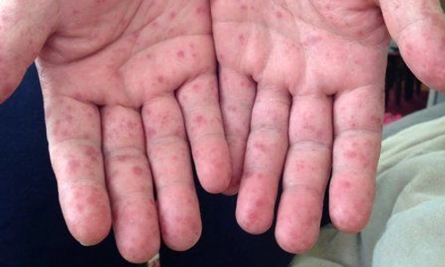 1 83608 original jpg jpeg