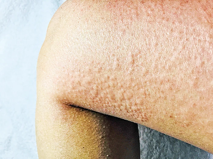 Pielea i se umple de iritaţii din cauza frigului din casă