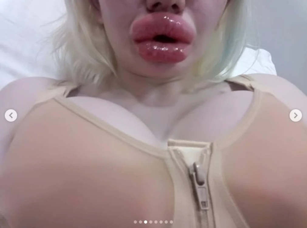 3 femeia cu cele mai mari buze din lume 3 jpg jpeg