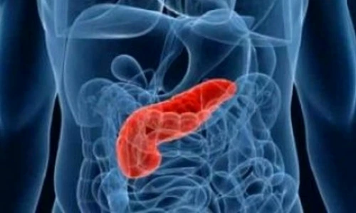 1 73692 original jpg jpeg