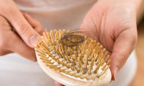 1 73611 original jpg jpeg