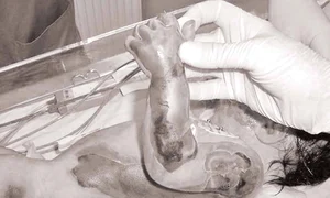 A murit după ce a căzut în vasul cu apă clocotită jpeg