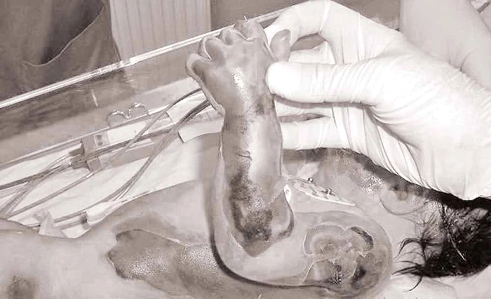 A murit după ce a căzut în vasul cu apă clocotită