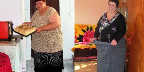 Claudia Miţoi înainte şi după operaţie