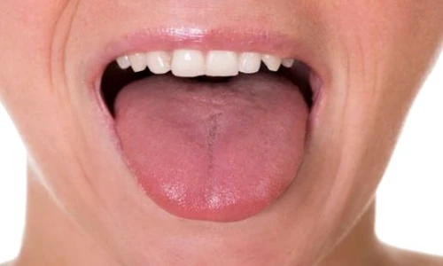 cancer de limbă simptome jpeg