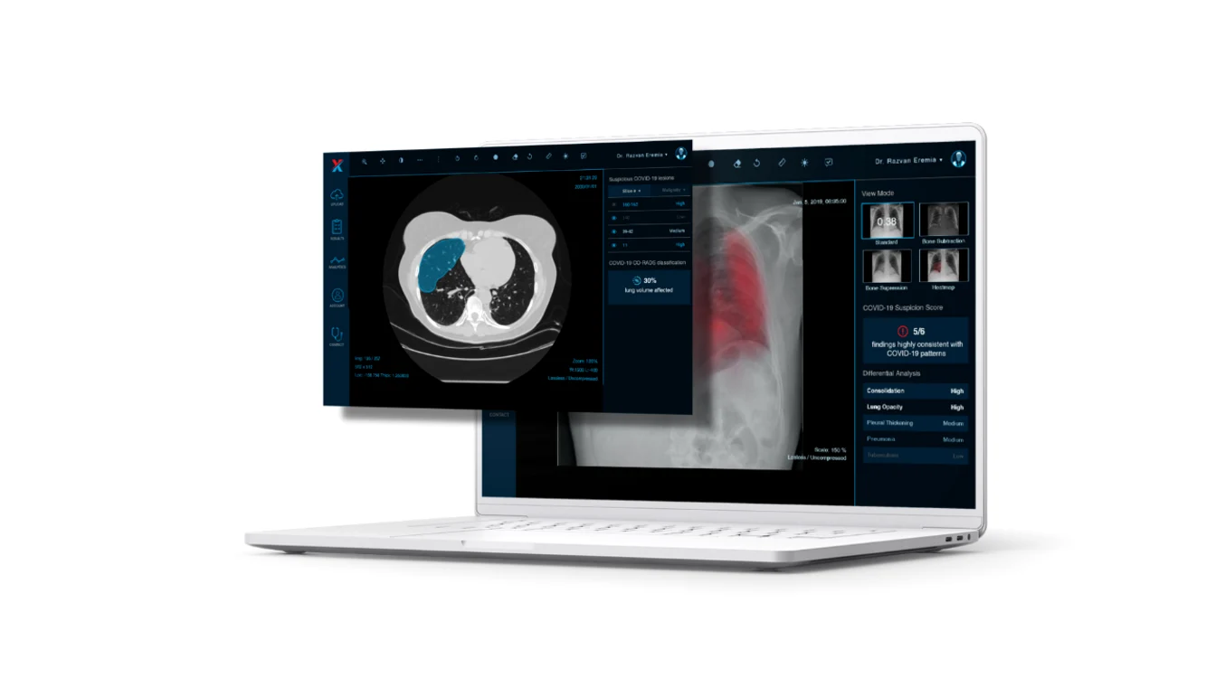 1 thumbnail xvision foto png png