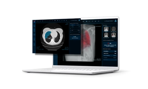 1 thumbnail xvision foto png png