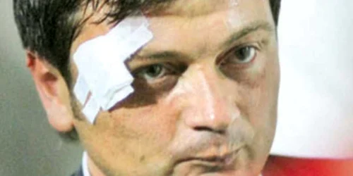 Aşa arăta Daniel Stanciu după meciul cu UTA