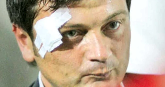 Aşa arăta Daniel Stanciu  după meciul cu UTA  