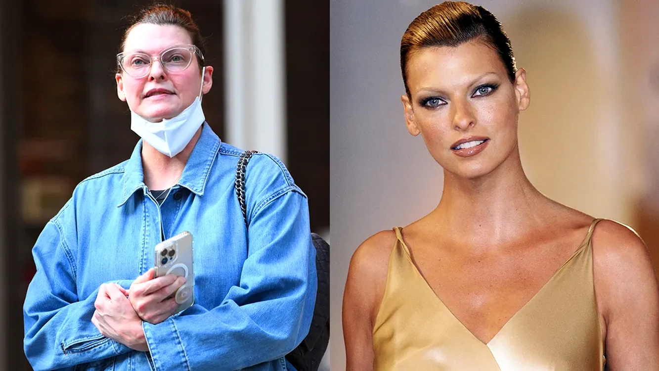 Linda Evangelista a fost desfigutată de o procedură estetică nereușită