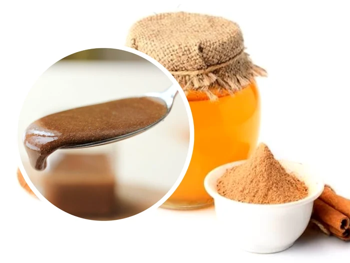 Pasta din miere și scorțișoară. Ce boli poți trata cu acest mixt făcut în casă