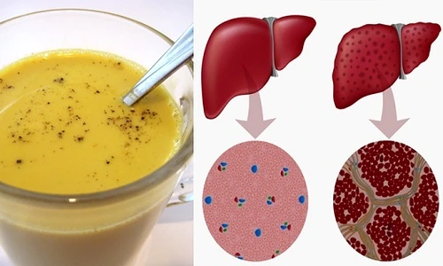 1 reteta geniala cum sa ti detoxifiezi ficatul in mai putin de o saptamana 2a5h jpg jpeg