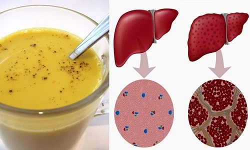 1 reteta geniala cum sa ti detoxifiezi ficatul in mai putin de o saptamana 2a5h jpg jpeg