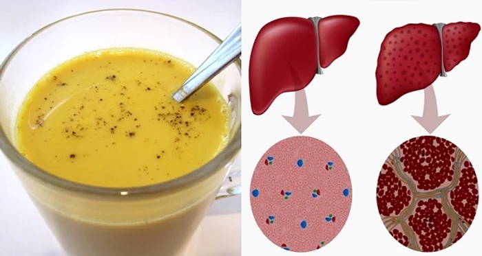 1 reteta geniala cum sa ti detoxifiezi ficatul in mai putin de o saptamana 2a5h jpg jpeg
