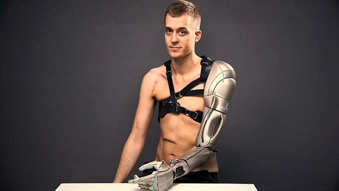 Braţul bionic este demn de filmele cu roboţi, fiind conectat la terminaţiile nervoase şi la muşchii din umărul lui James, FOTO Daily Mail