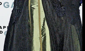 barbra operatii 74 faciale jpeg